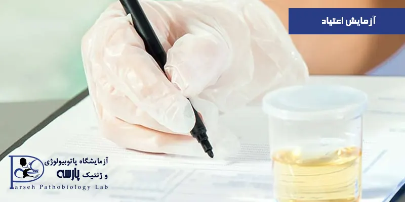 آزمایش-اعتیاد