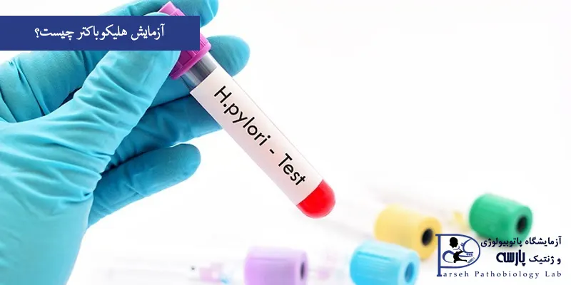 آزمایش-هلیکوباکتر-چیست؟