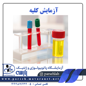 آزمایش کلیه