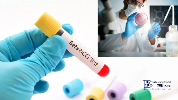 آزمایش Beta-hCG