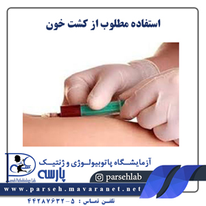 استفاده مطلوب از کشت خون