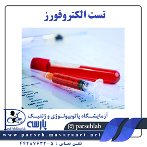 تست الکتروفورز