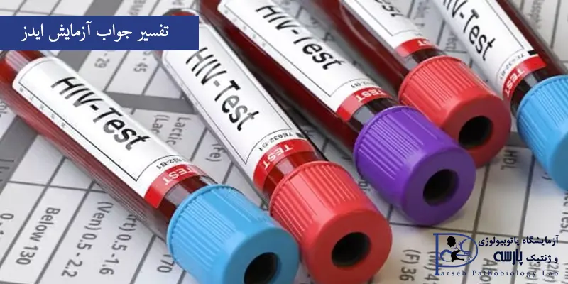 تفسیر-جواب-آزمایش-ایدز