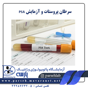 سرطان پروستات و آزمايش PSA