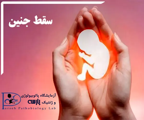 سقط درمانی