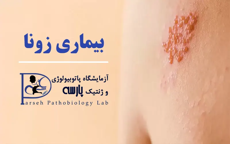 عکس زونا