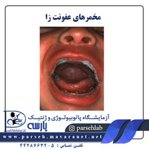 مخمرهای عفونت زا