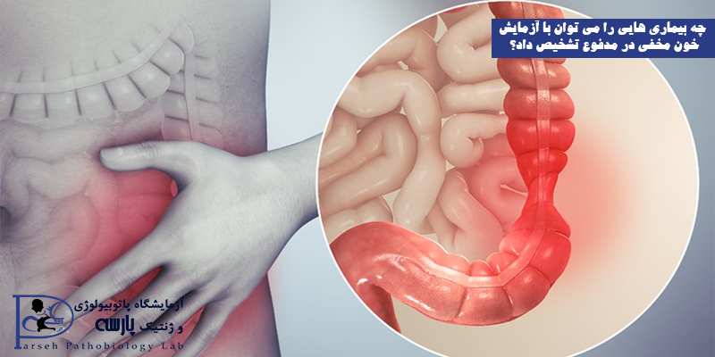 چه-بیماری-هایی-را-می-توان-با-آزمایش-خون-مخفی-در-مدفوع-تشخیص-داد؟