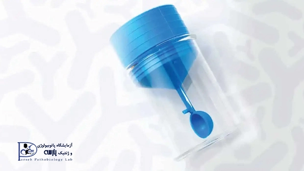 کالپروتکتین