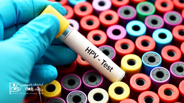آزمایش ویروس HPV