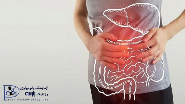 IBD چیست