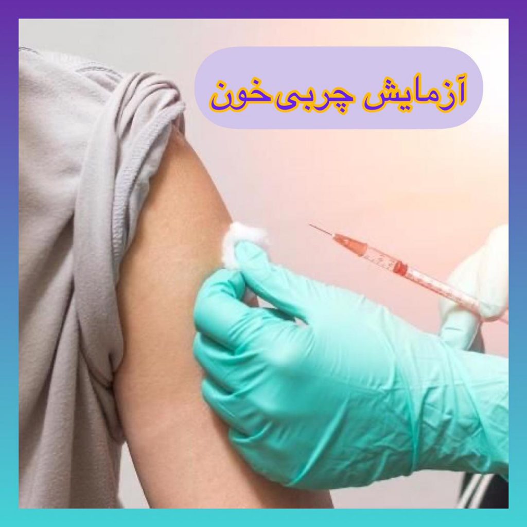 آزمایش چربی خون