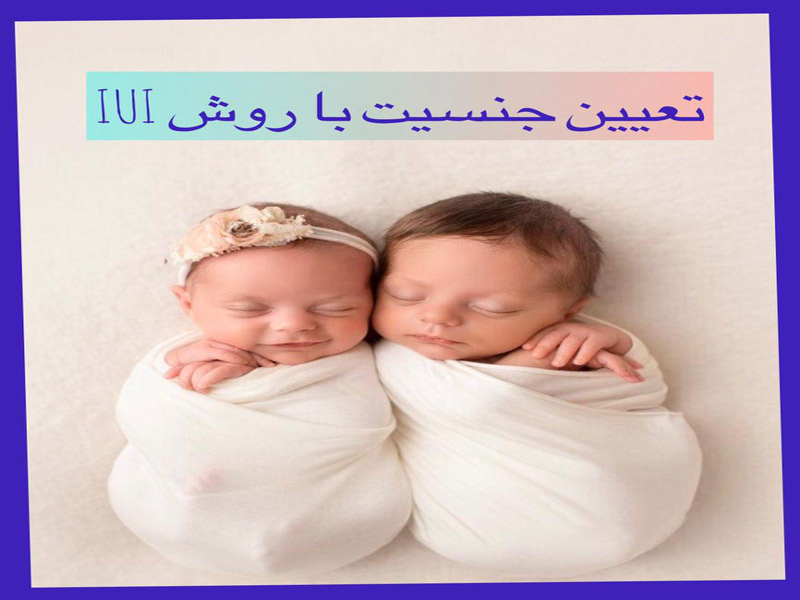 تعیین جنسیت