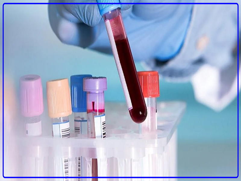 تست خون