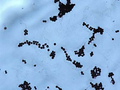 Cryptococcus Gram film1