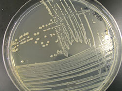 E.coli culture