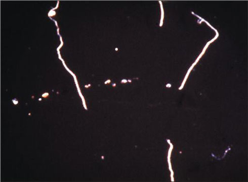 leptosporai interrogans