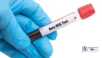 آزمایش Beta-hCG