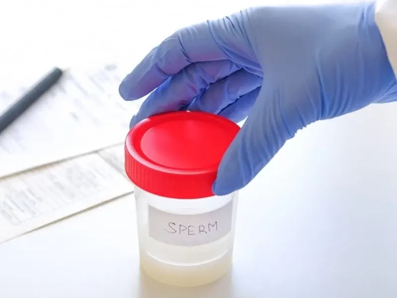 آزمایش اسپرموگرام