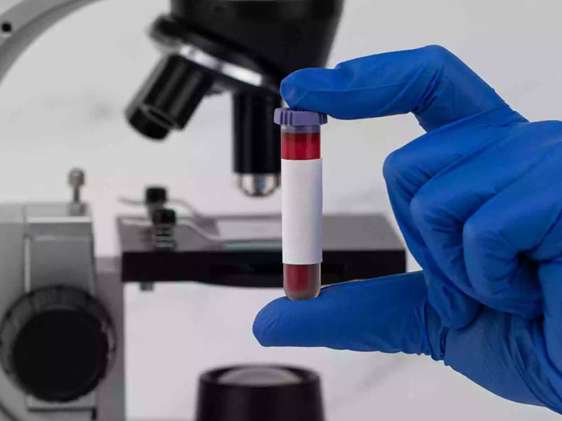 آزمایش خون مخفی در مدفوع