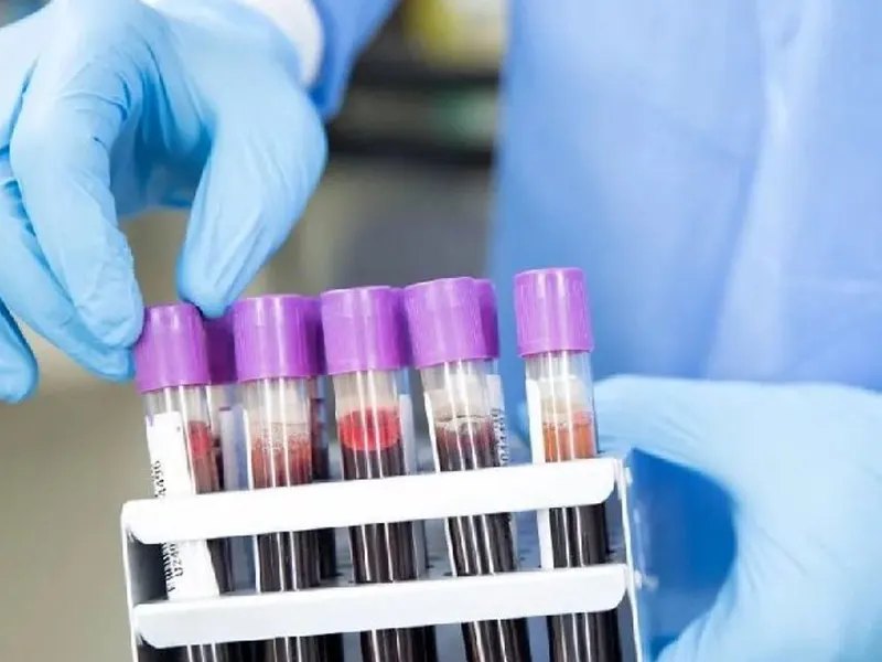 آزمایش سرولوژی