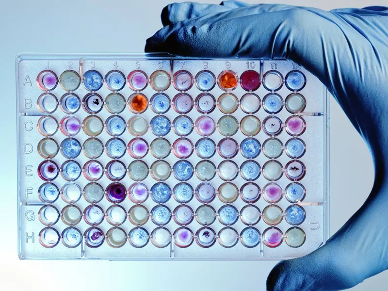 آزمایش های هورمون شناسی چه هستند