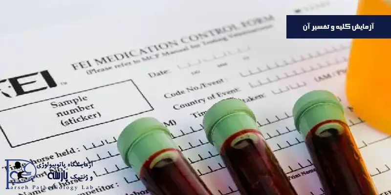 آزمایش کلیه و تفسیر آن