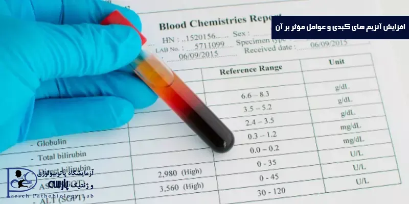 آنزیم-های-کبدی-و-عوامل-مؤثر-بر-آن