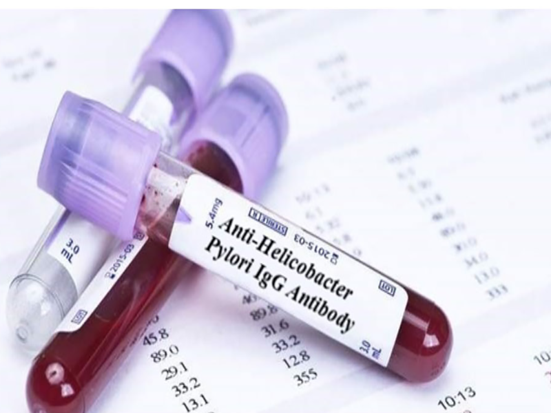 ازمایش باکتری معده پارسه