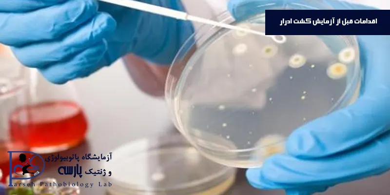 اقدامات-قبل-از-آزمایش-کشت-ادرار