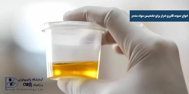 انواع-نمونه-گیری-ادرار-برای-تشخیص-مواد-مخدر