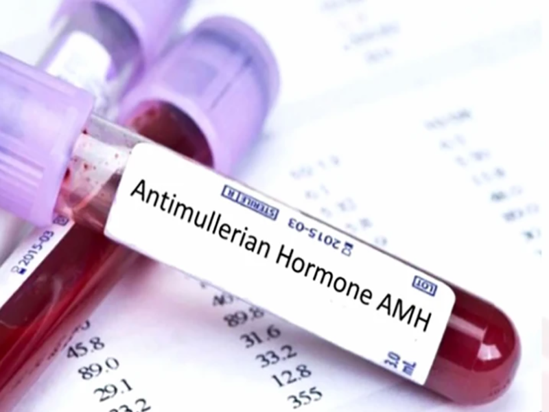 بررسی هورمون آنتی مولرین amh