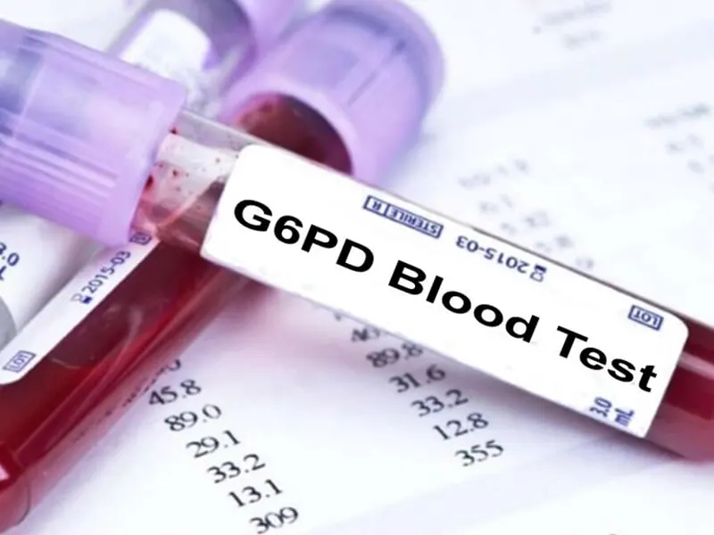 بیماری فاویسم