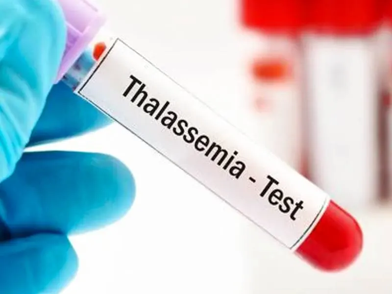 تشخیص تالاسمی