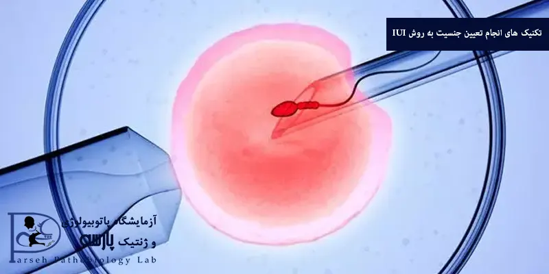 تکنیک های انجام تعیین جنسیت به روش IUI