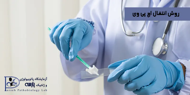 روش-انتقال-اچ-پی-وی