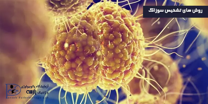 روش-های-تشخیص-سوزاک