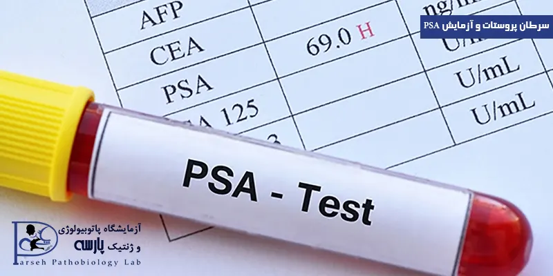 سرطان پروستات و آزمایش PSA