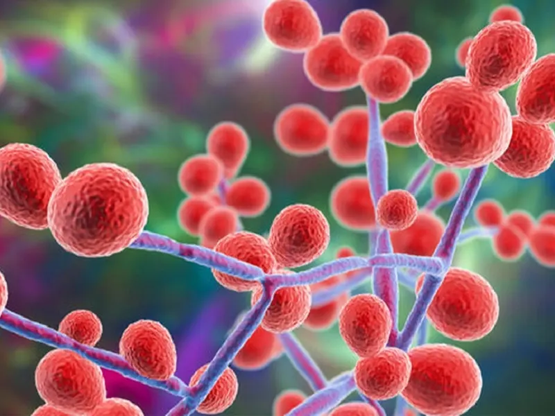 عفونت های قارچی