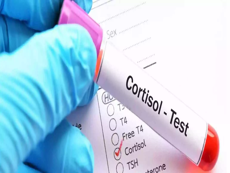 علائم بالابودن هورمون کورتیزول