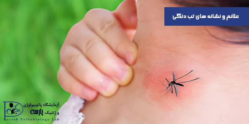 علائم-و-نشانه-های-تب-دنگی