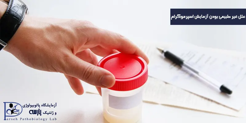 علل-غیر-طبیعی-بودن-آزمایش-اسپرموگرام