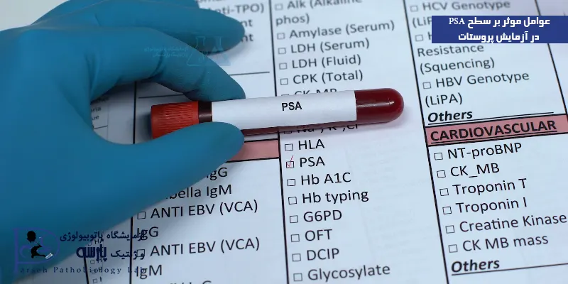 عوامل-موثر-بر-سطح-PSA-در-آزمایش-پروستات