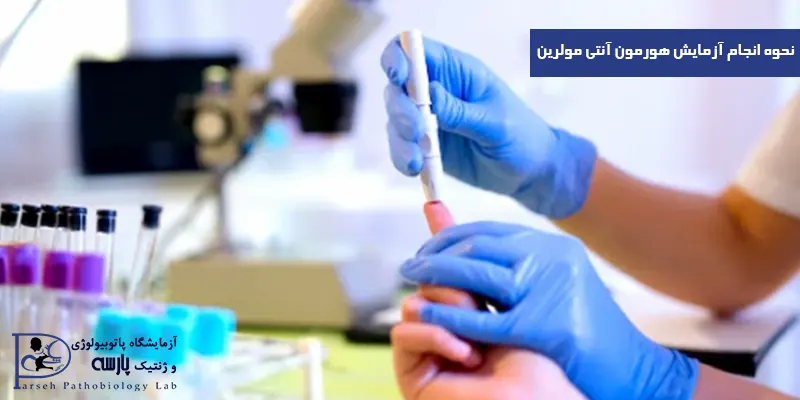 نحوه-انجام-آزمایش-هورمون-آنتی-مولرین