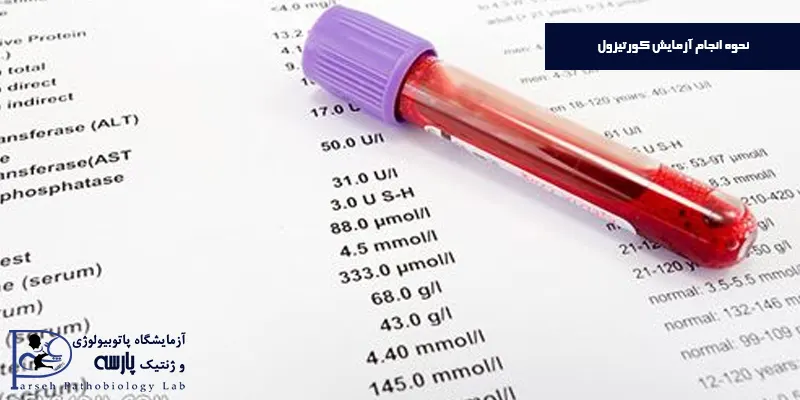 نحوه-انجام-آزمایش-کورتیزول