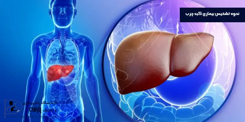 نحوه-تشخیص-بیماری-کبد-چرب