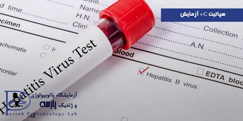 هپاتیت C + آزمایش