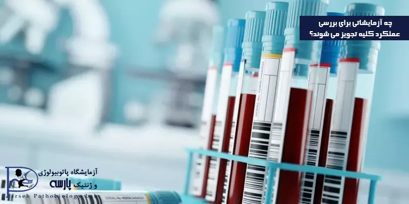 چه-آزمایشاتی-برای-بررسی-عملکرد-کلیه-تجویز-می-شوند؟