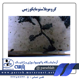 کروموبلاستومایکوزیس